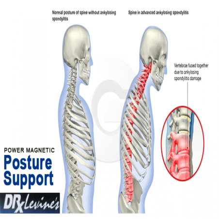 Magniten-kolan-za-grb-na-d-r-Livajn-Dr-Levine-Posture-support