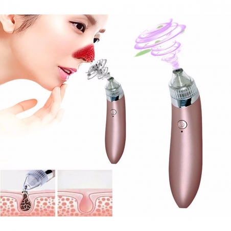 Vakuumen-ured-za-pocistvane-na-pori-i-cerni-tocki-XN-8030