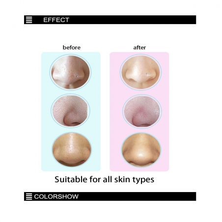 Vakuumen-ured-za-pocistvane-na-pori-i-cerni-tocki-XN-8030