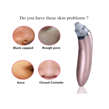 Vakuumen-ured-za-pocistvane-na-pori-i-cerni-tocki-XN-8030