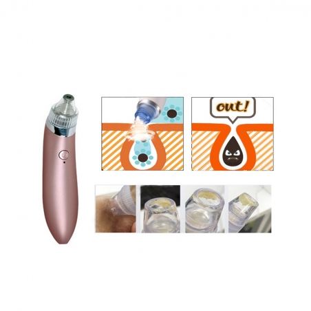 Vakuumen-ured-za-pocistvane-na-pori-i-cerni-tocki-XN-8030