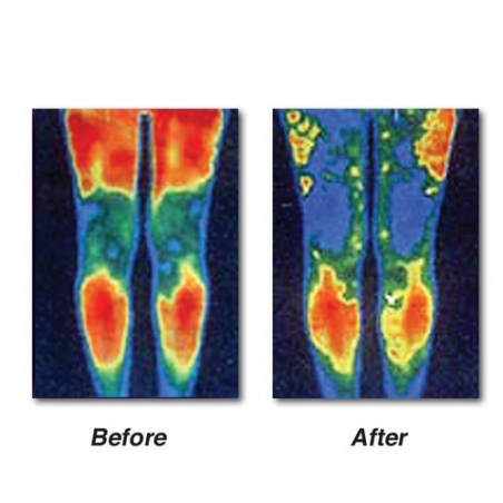 Masazor-za-podobravane-na-krvoobrasenieto-i-oblekcavane-na-bolkite-v-krakata-Leg-O-Sage-Pulse-Massager