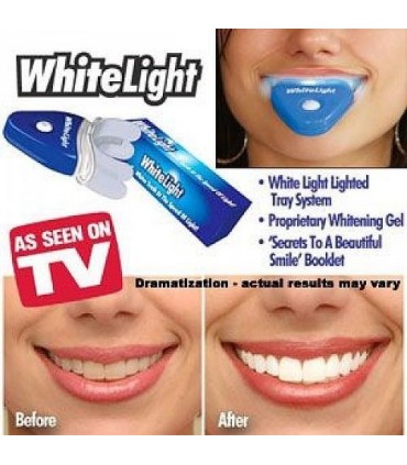 Сет за избелване на зъби WhiteLight