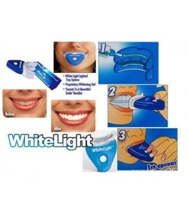 Сет за избелване на зъби WhiteLight