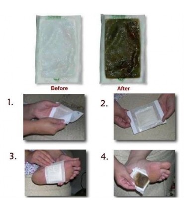 Пластири за детоксикация Kinoki Detox Pads 10 бр.