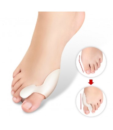 Силиконови Разделители Срещу Изпъкнали Кокалчета