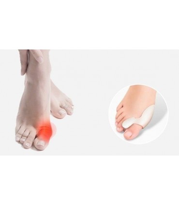 Силиконови Разделители Срещу Изпъкнали Кокалчета