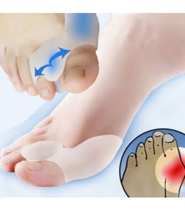 Силиконови Разделители Срещу Изпъкнали Кокалчета