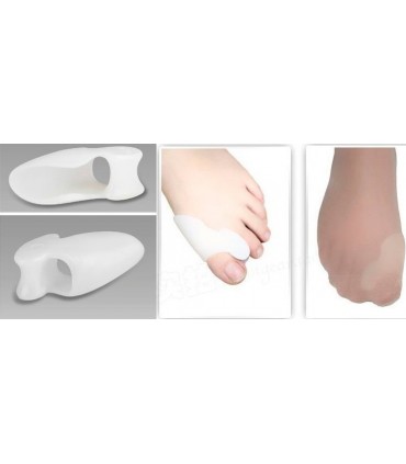 Силиконови Разделители Срещу Изпъкнали Кокалчета