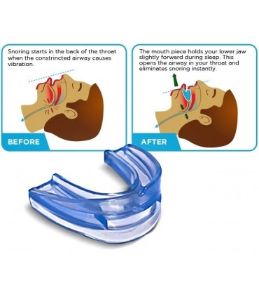 Шина-Ортеза против хъркане