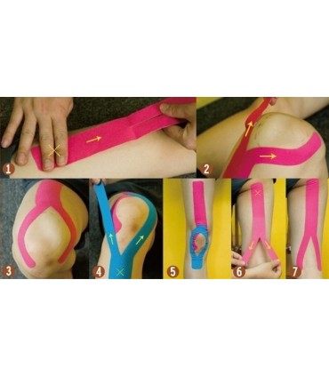 Кинезитерапия с кинезиологични лепенки - ленти