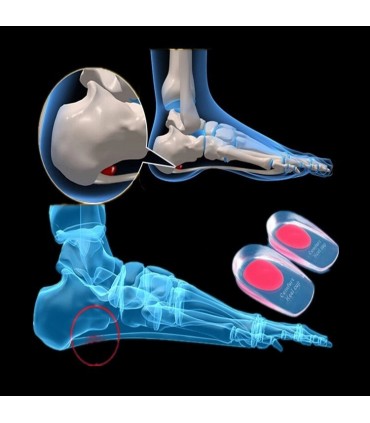 Силиконови гел подложки за пети