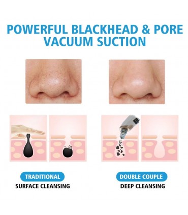 ВАКУУМЕН УРЕД ЗА ПОЧИСТВАНЕ НА ЛИЦЕ