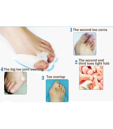 Силиконов сепаратор за първи и втори пръст на крака