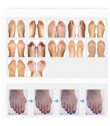 Силиконов сепаратор за първи и втори пръст на крака