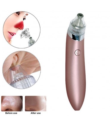 Вакуум уред за акне и черни точки