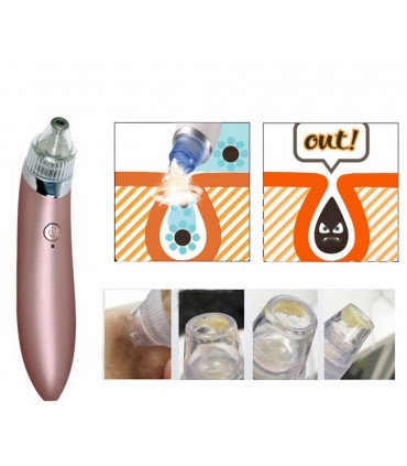 Вакуум уред за акне и черни точки