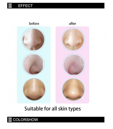 Вакуум уред за акне и черни точки