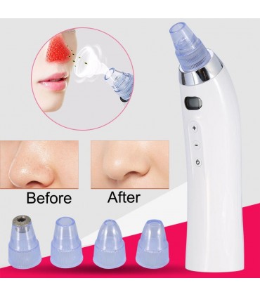 Вакуум уред за почистване на лицето от черни точки и акне, модел с дисплей